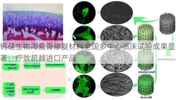 钙硅生物陶瓷骨修复材料全国多中心临床试验成果显著，疗效超越进口产品